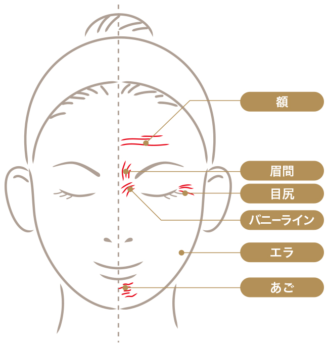 見た目年齢を左右する「シワ」 | 肌管理クリニック